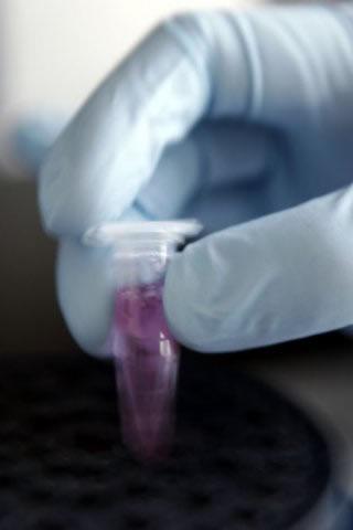 Descoperire: Celulele din pielea umană pot fi transformate în celule suşă