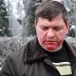 Director Boliacu:” Un individ a sărit la gâtul meu, m-a sugrumat şi m-a lovit în mai multe rânduri în faţă”