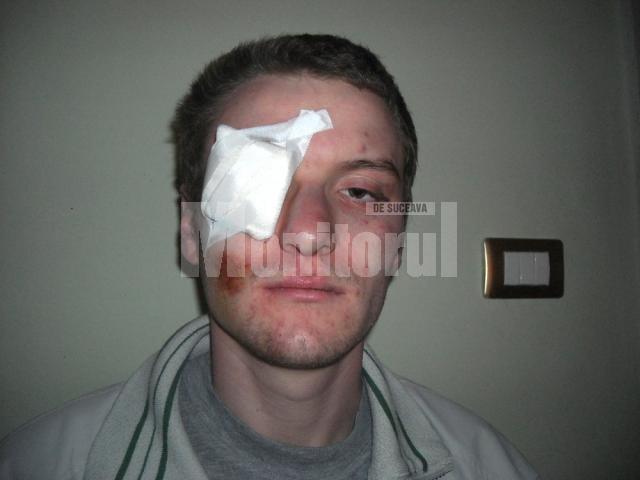 Radu Iacob, tânărul care reclamă că a fost bătut crunt de poliţişti