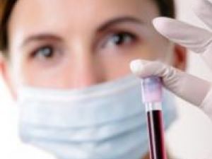 Un nou test sangvin pentru detectarea timpurie a celulelor canceroase, în curând pe piaţă
