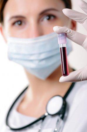 Un nou test sangvin pentru detectarea timpurie a celulelor canceroase, în curând pe piaţă