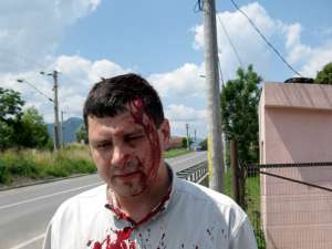 Inspectorul Viorel Ciuc, bătut de un consilier local  din Câmpulung Moldovenesc