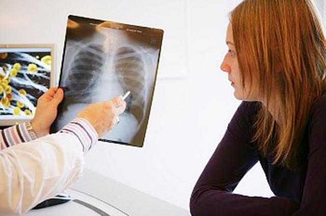 Astmul este o boală cronică de plămâni, caracterizată prin probleme recurente de respiraţie