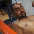 Dumitru Bergheaua a ajuns la spital cu o plagă scalpată, fiind lovit în cap cu un obiect contondent