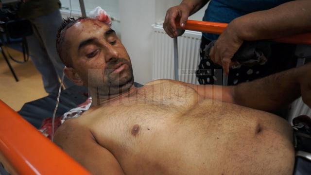 Dumitru Bergheaua a ajuns la spital cu o plagă scalpată, fiind lovit în cap cu un obiect contondent
