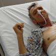 Pacientul cu vezica nouă, Ioan Lazăr, în vârstă de 61 de ani, din Preuteşti