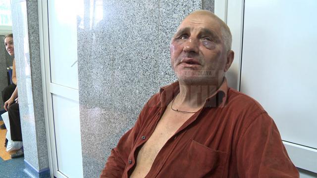 Mihai Duţuc, bărbatul de 67 de ani, ajuns cu faţa tumefiată de lovituri la spital