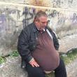 Un bărbat de 240 de kilograme, cu obezitate morbidă, plimbat de la un spital la altul