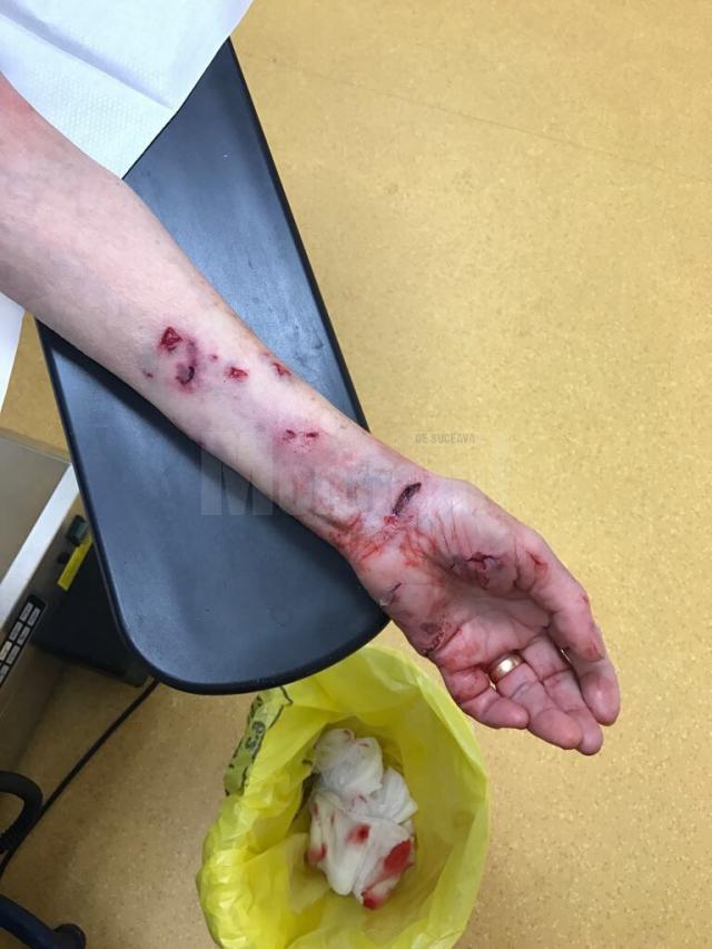 Mâna bătrânei atacate de câine