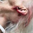 O parte din urechea bătrânei a fost smulsă în urma agresiunii