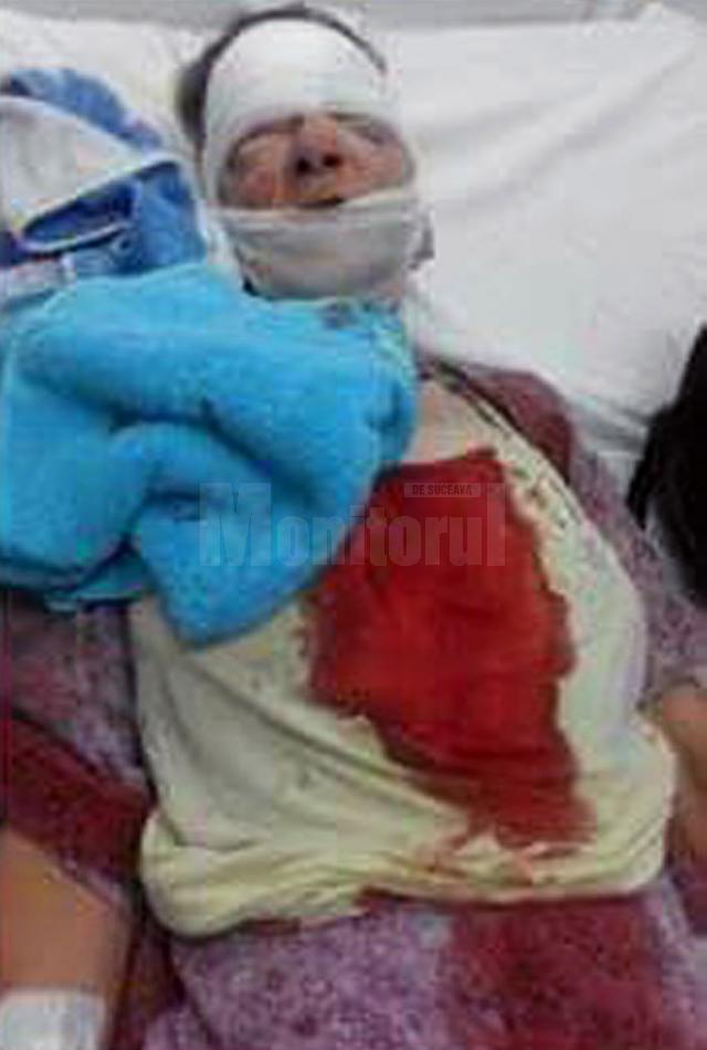 Viorica Bucătaru a ajuns în stare gravă la spital, după care a fost operată de urgenţă într-o clinică din Iaşi