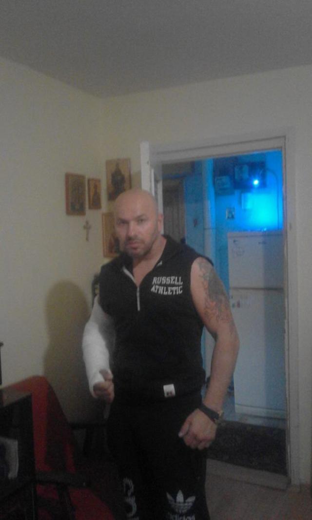Lucian Văduva, cu mâna în ghips după agresiunea din stradă