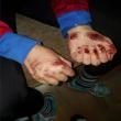 Mâinile Gianinei Belegă, roase până la sânge