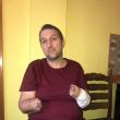 Constantin Cazac, în vârstă de 40 de ani, cu ambele mâini amputate, în urma unui accident, are nevoie urgent de două proteze