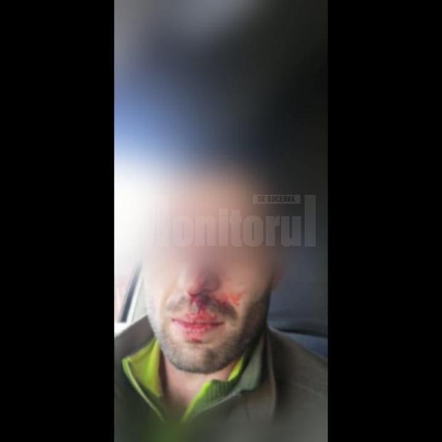 Pădurarul din Moldoviţa, care apare în filmarea Recorder despre hoţii de lemne, a fost bătut FOTO legeacodrului.ro