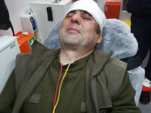 Paznicul de vanatoare Ilie Drob a ajuns la spital cu un traumatism cranio cerebral puternic