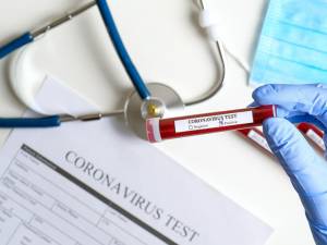 Testarea de coronavirus a populației, solicitată de primarul Sucevei. Foto: EuropaFM