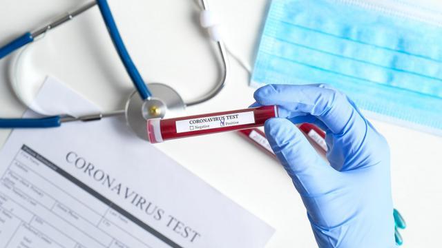 27 de noi cazuri de coronavirus au fost raportate de către autorități luni, 18 mai Sursa foto europafm.ro