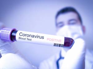 34 de cazuri noi de coronavirus în județul Suceava. Foto: jurnalulolteniei.ro