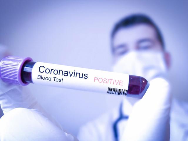 34 de cazuri noi de coronavirus în județul Suceava. Foto: jurnalulolteniei.ro