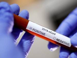Din nou scădere a numărului de cazuri de coronavirus din județul Suceava