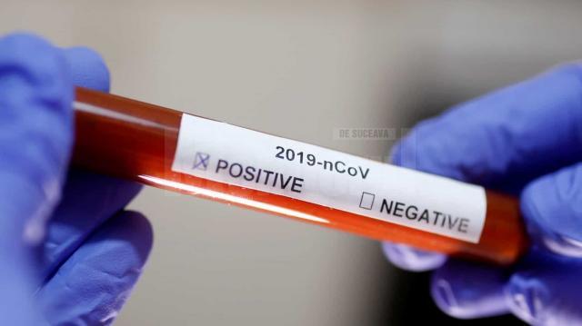 În urma testelor efectuate la nivel național au fost înregistrate 1.415 de cazuri noi de persoane infectate