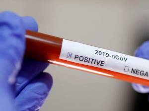 În urma testelor efectuate la nivel național au fost înregistrate 1.415 de cazuri noi de persoane infectate
