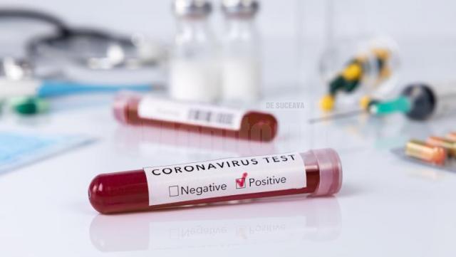 Numărul total de persoane testate până în prezent de coronavirus, din județul Suceava, este de 38195 persoane