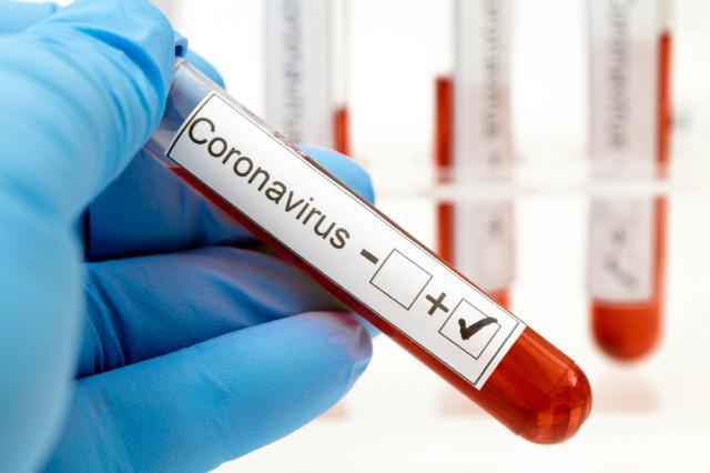 53 de cazuri noi de coronavirus în județul Suceava