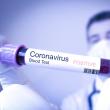 Încă șase cadre didactice depistate cu coronavirus