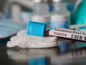 Din 138 de persoane testate, 38 au fost depistate luni cu coronavirus. Foto: digi24.ro