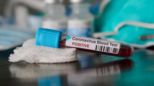 Din 138 de persoane testate, 38 au fost depistate luni cu coronavirus. Foto: digi24.ro