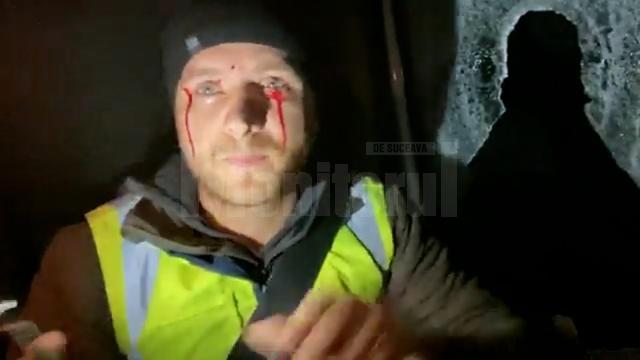 Activistul Bodnar, rănit în urma unui atac cu bolovani, la un gater din Mălini