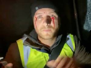 Activistul Bodnar, rănit în urma unui atac cu bolovani