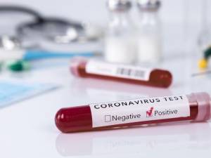 În urma testelor efectuate la nivel național au fost înregistrate 2.699 cazuri noi de persoane infectate cu SARS – CoV – 2