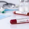 90 de suceveni infectați cu noul coronavirus, de joi până vineri