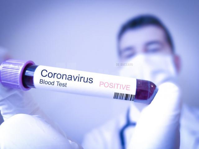Miercuri: 14 cazuri noi de infectare cu SARS-CoV-2 în județul Suceava. Foto jurnalulolteniei.ro