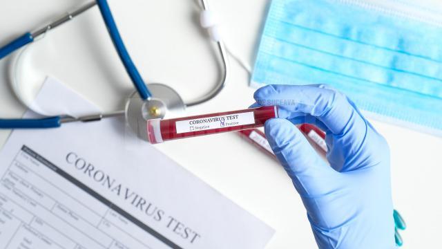 Două zile consecutive fără nici un caz nou de coronavirus în județul Suceava