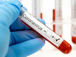 Scădere ușoară a numărului de cazuri noi de coronavirus din județul Suceava