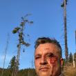 Activistul Tiberiu Boșutar, agresat în urma unei altercații în pădure - FOTO Facebook Legea codrului