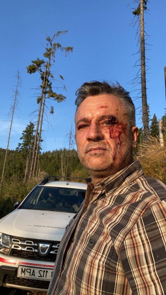 Activistul Tiberiu Boșutar, agresat în urma unei altercații în pădure - FOTO Facebook Legea codrului