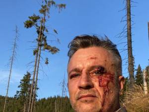 Activistul Tiberiu Boșutar, agresat în urma unei altercații în pădure Foto Facebook Legea codrului
