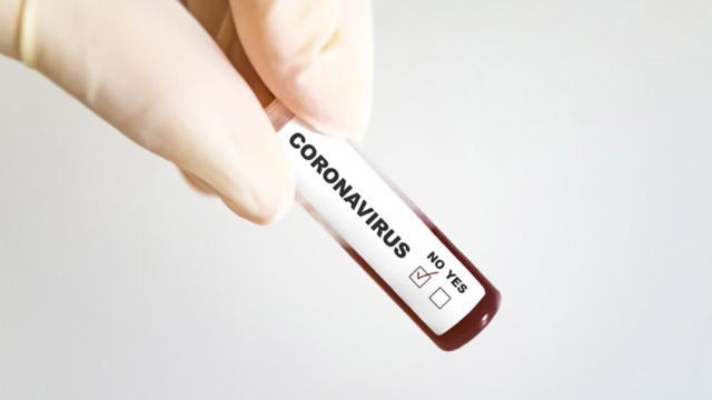 Test coronavirus