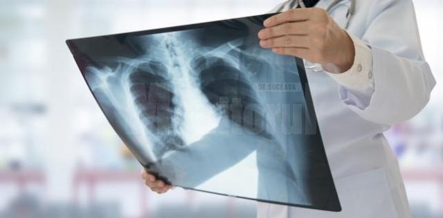 Radiografie a plămânilor. Foto sfatul medicului.ro