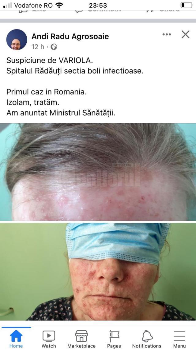 Postarea medicului Andi Radu Agrosoaie