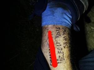 Turistul epuizat de efort a scris cu marker pe picior CNP-ul, numele şi numărul maşinii, înmatriculată în Suceava