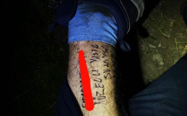 Turistul epuizat de efort a scris cu marker pe picior CNP-ul, numele şi numărul maşinii, înmatriculată în Suceava