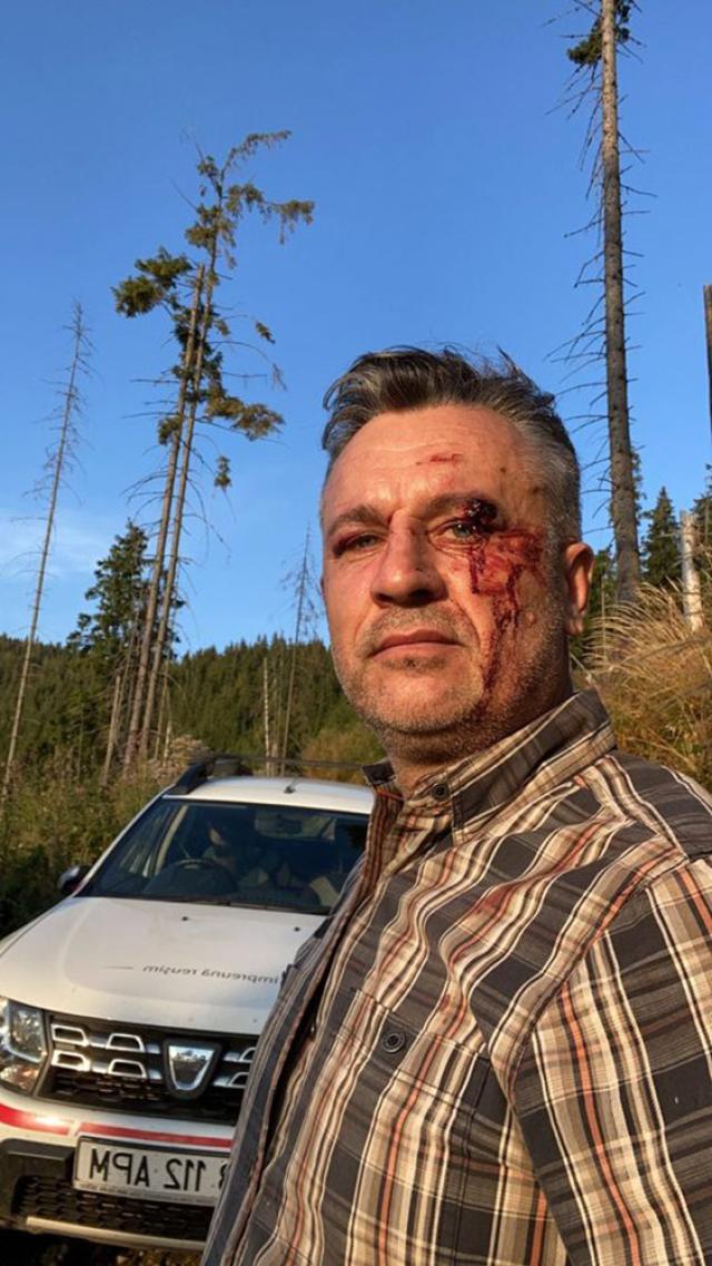 Activistul Tiberiu Boșutar, în septembrie 2021, când a fost agresat în urma unei altercații în pădure Foto Facebook Legea codrului