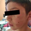 Copilul de 11 ani agresat de Daniel Dumitru Chirap
