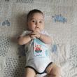 Băiețelul cu malformație congenitală la piciorul drept va fi operat la o clinică din Austria